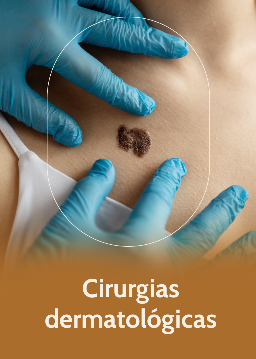 Imagem_CIRURGIA_DERMATOLOGICAS
